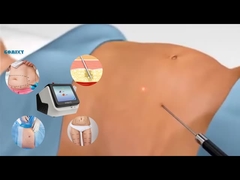 Thiết bị Laser Lipo 30W 60W 980nm Diode Lipo Laser Machine Để giảm cân